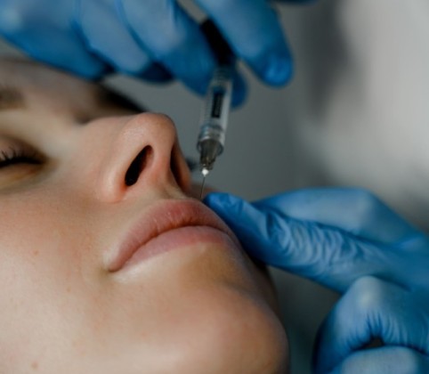 Мезотерапия